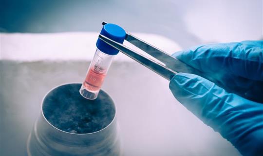 Cell and gene therapy cryogenic vial
