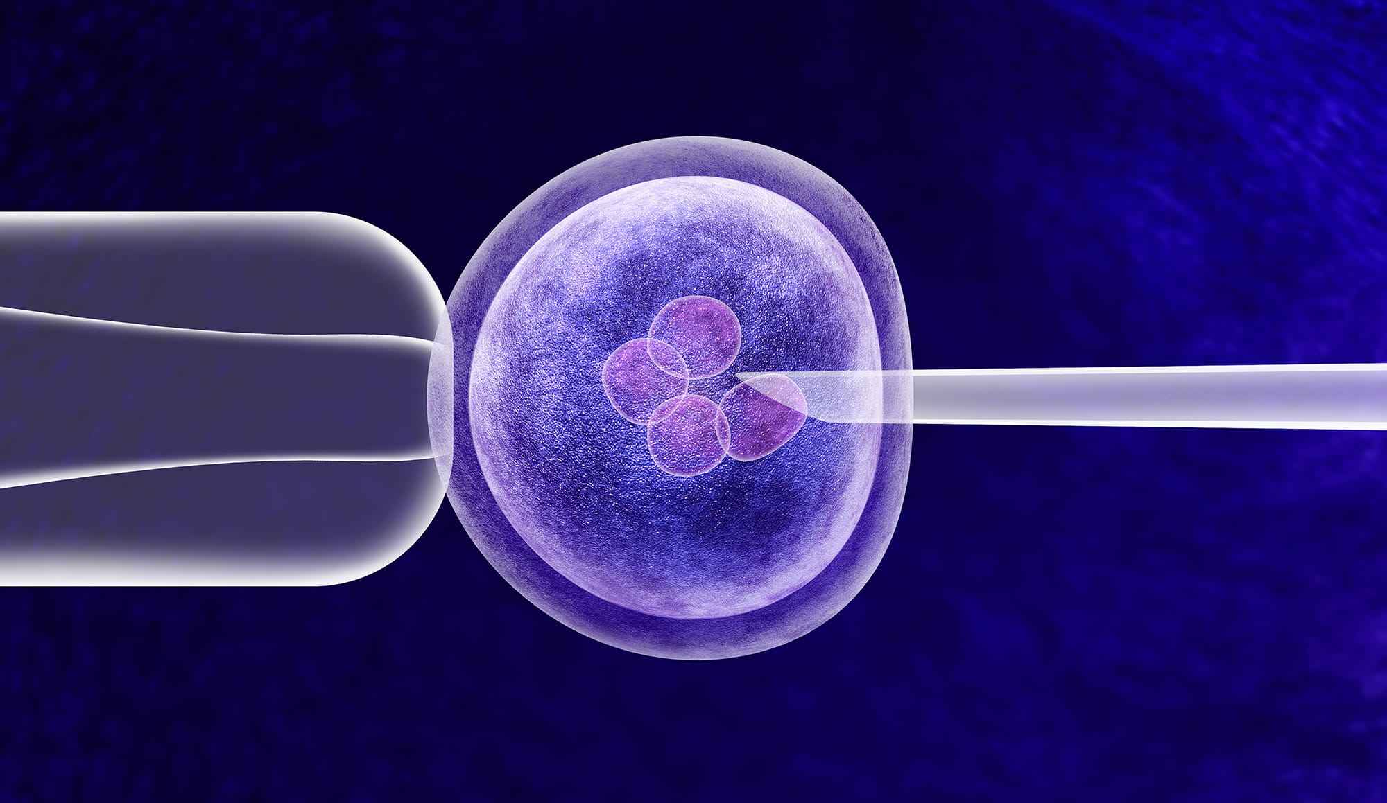 Fresh or frozen: the supply chain needs of your cell and gene therapy